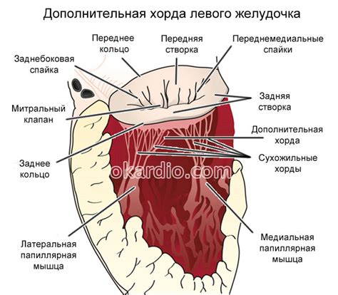 Что такое ложные хорды в левом желудочке?