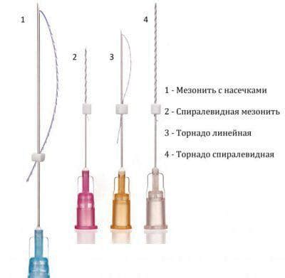 Что такое мононити?