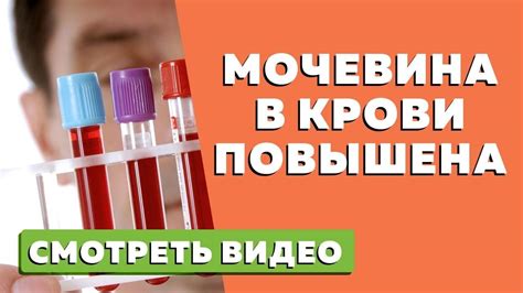 Что такое мочевина в крови и почему она повышается у мужчин?