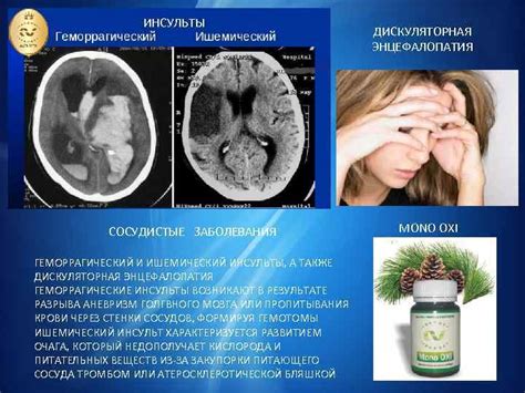 Что такое органическое поражение центральной нервной системы?