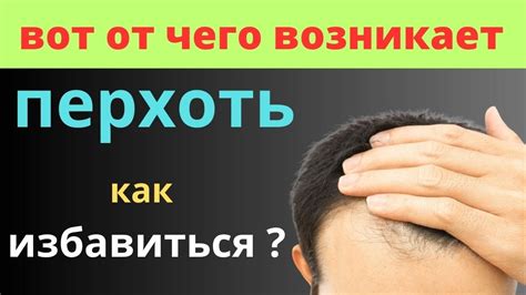 Что такое перхоть