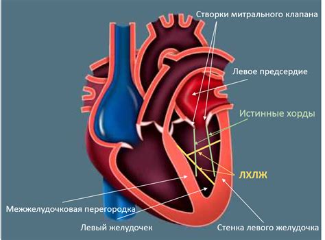 Что такое сердечная хорда у детей?