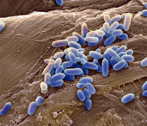 Что такое Pseudomonas aeruginosa у собаки?