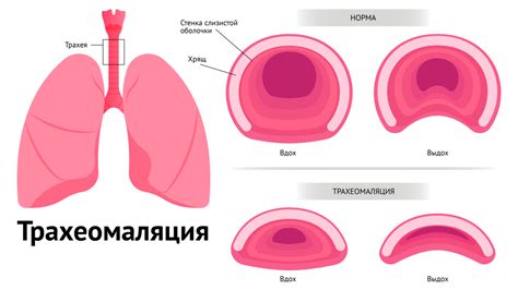 Шумное дыхание