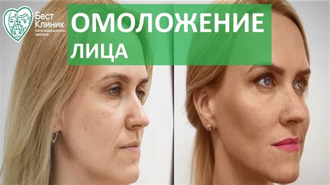 Эффективность аппаратного массажа лица при борьбе с возрастными изменениями