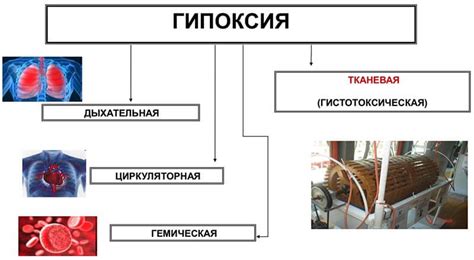 Эффективные методы лечения сепсиса легких