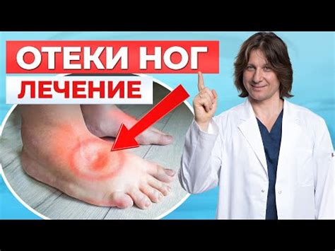 Эффективные способы лечения отека