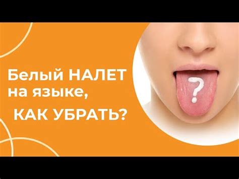 Эффективные способы удаления белого налета на языке