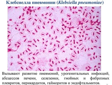  Как определить Klebsiella pneumoniae в посеве 