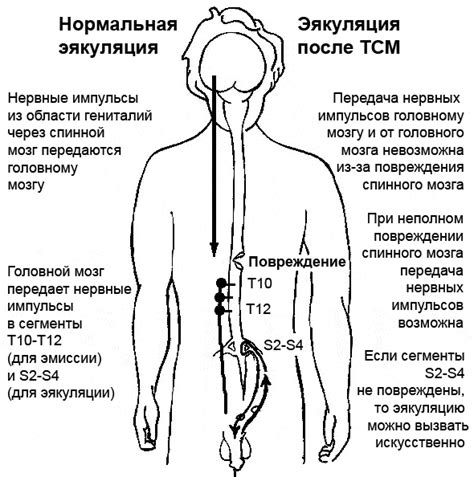  Что такое быстрая эякуляция и как она возникает? 