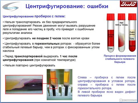  Что такое гемолиз крови? 