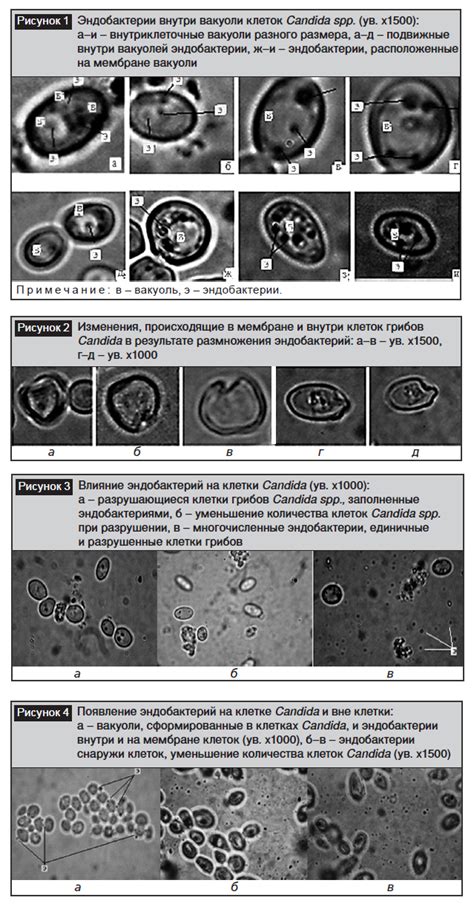 Candida spp: особенности и методы лечения